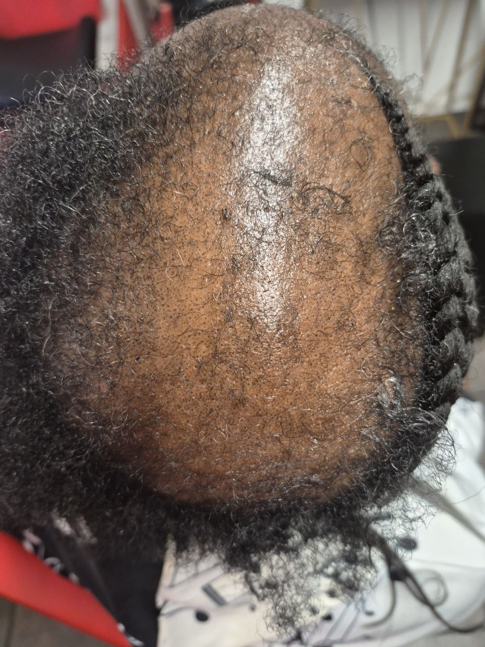 Alopecia Coverup on natural hair - Milly's FAB Tucson salon