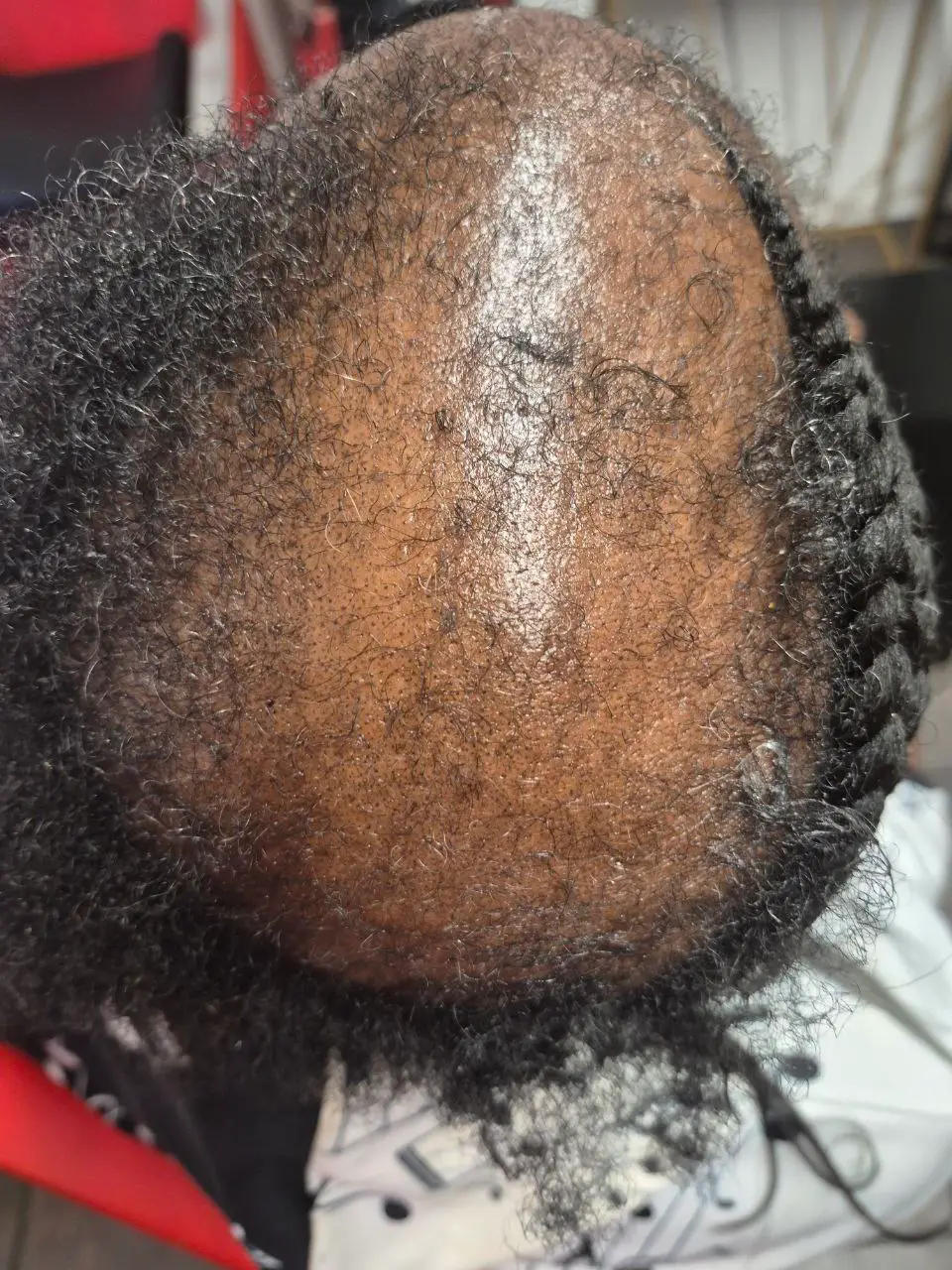 Alopecia Coverup on natural hair - Milly's FAB Tucson salon