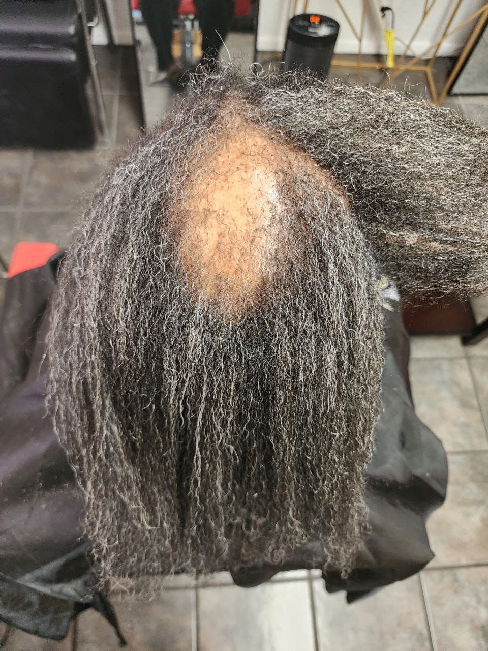 Alopecia Coverup by Milly's FAB - Tucson's premier hair braiding salon